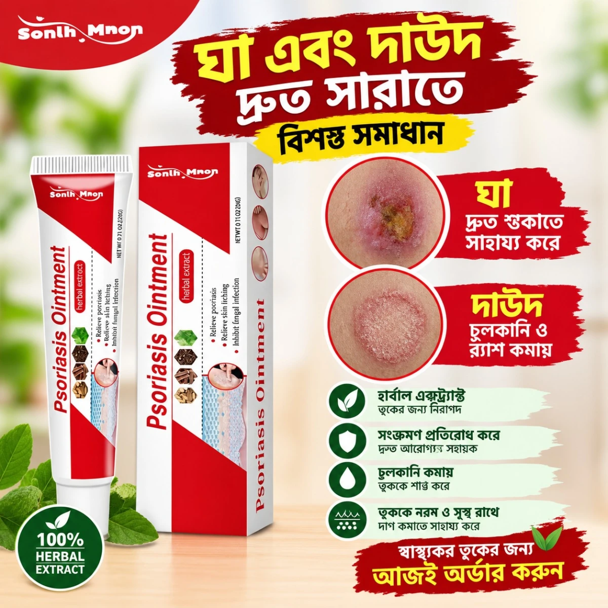 Psoriasis Ointment 20gm (চুলকানি, দাউদ ও ত্বকের সমস্যার জন্য)